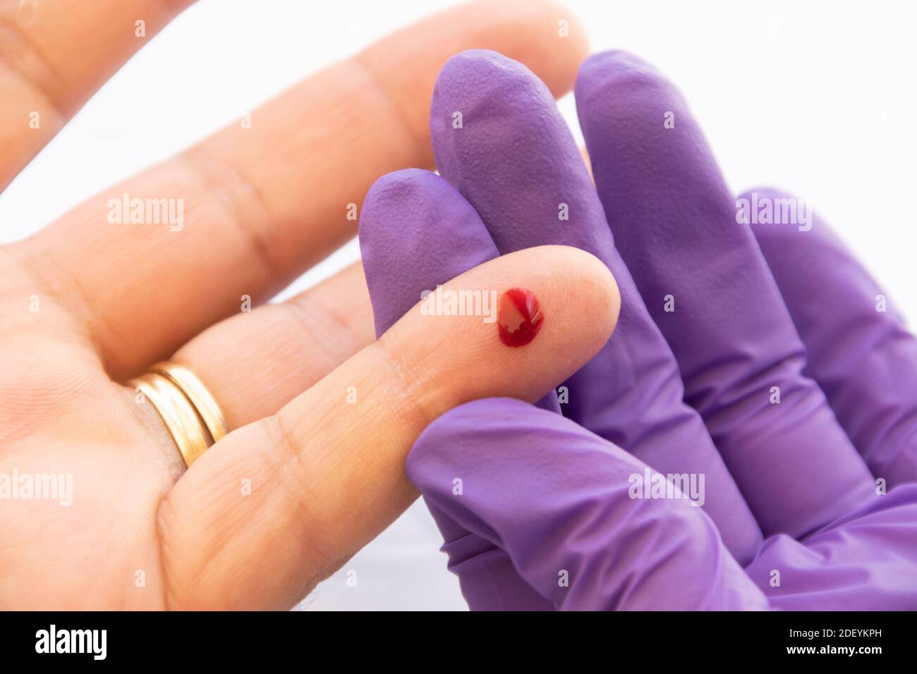 Close up of a male hand with a drop of blood for a glucose test