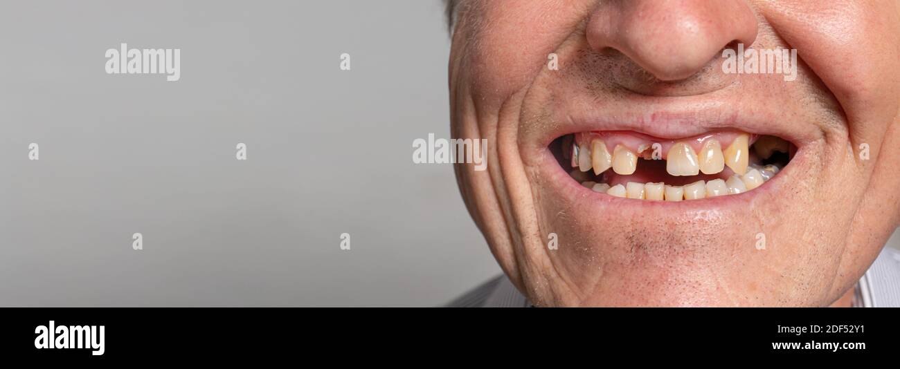 The toothless smile of an old European man on a gray background. Dentistry for pensioners, happy old age Stock Photo