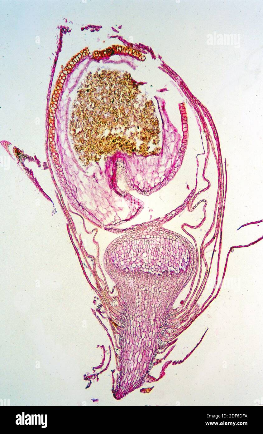 Moss capsule with spores (Sphagnum sp. ). Optical microscope, Magnification X20 Stock Photo Alamy