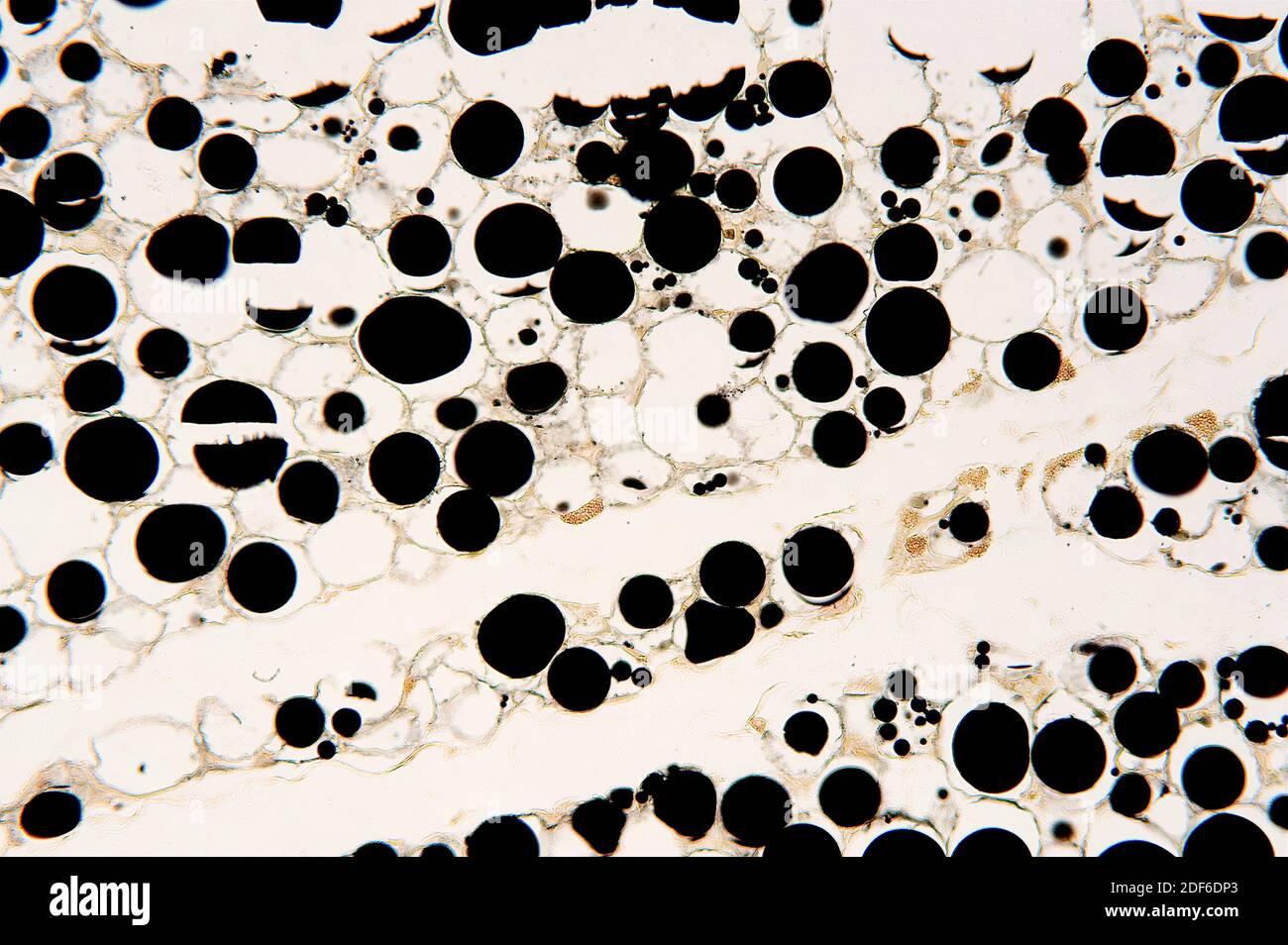 Adipose tissue with adipocites, stored lipids and nucleus. Optical microscope, magnification X100. Stock Photo