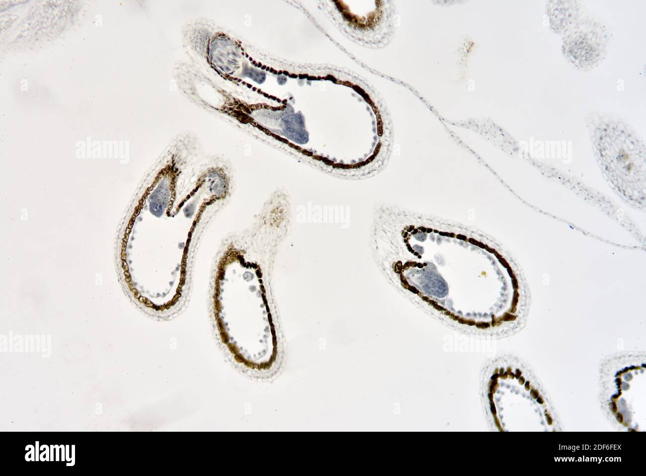 Inmature embryo of shepherd purse (Capsella bursa-pastoris). Optical microscope X40. Stock Photo