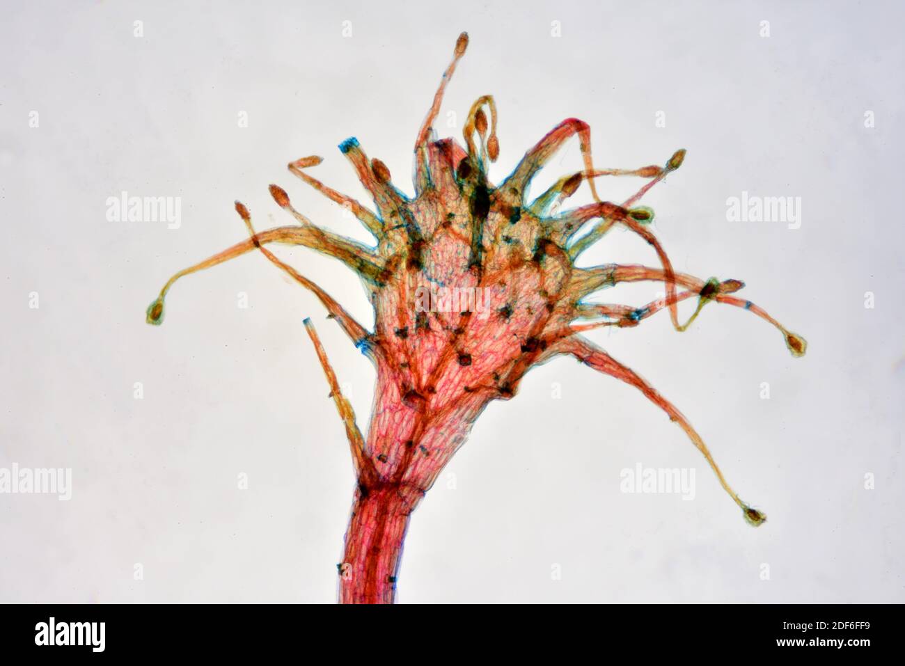 Stolked mucilaginous glands of sundew leafs (Drosera sp. ) a carnivorous plant. Optical microscope X40. Stock Photo