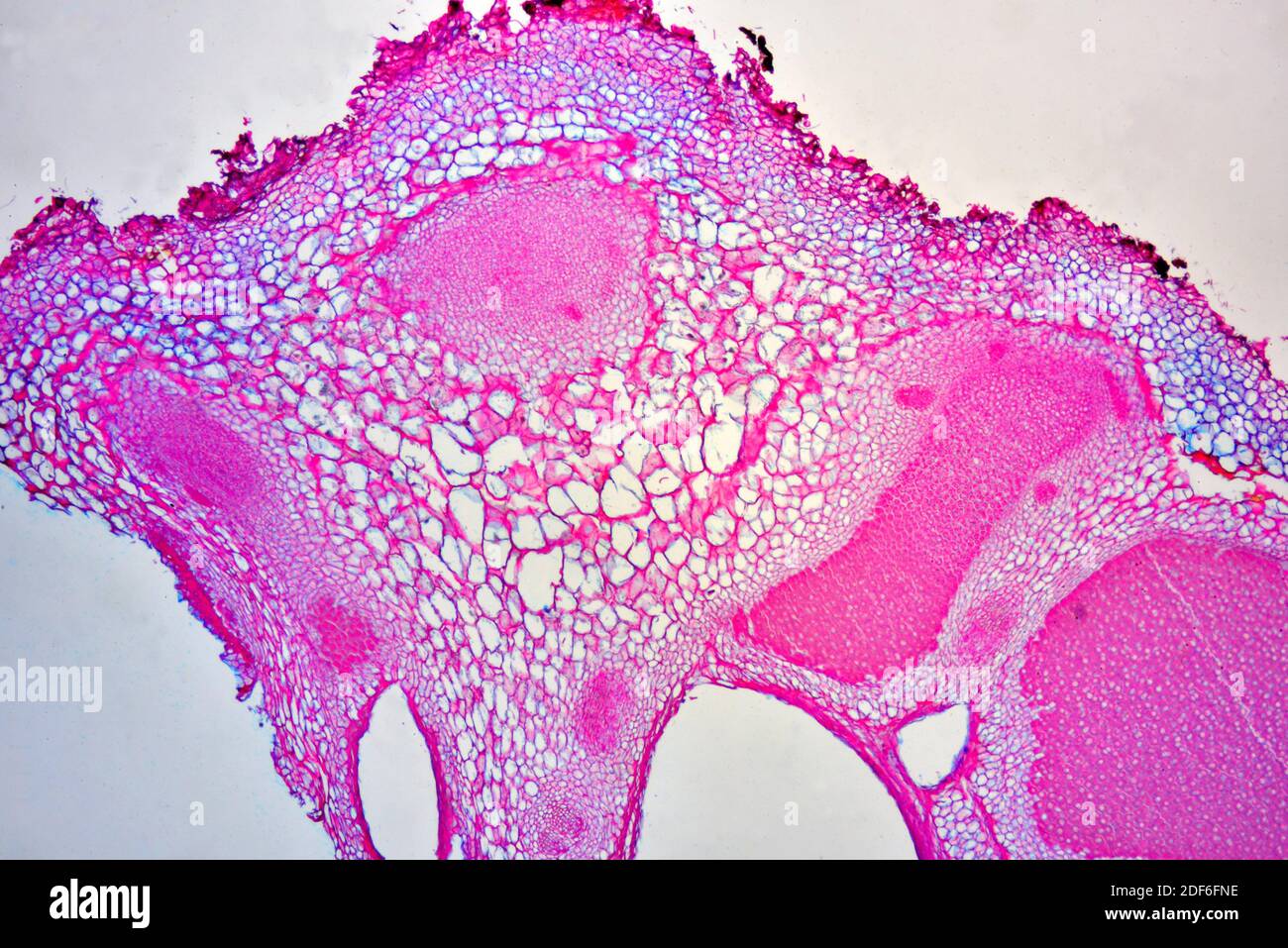 Lupinus root (cross section) with Rhizobium radicicola, fix nitrogen bacteria. Optical microscope X40. Stock Photo