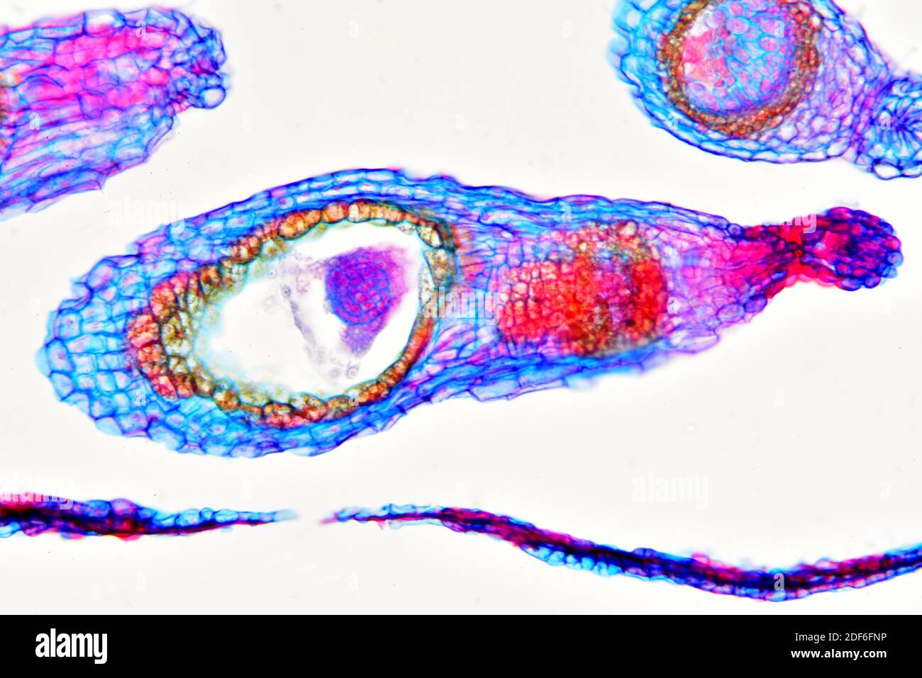Ovary with embryos of shepherd purse (Capsella bursa-pastoris). Optical microscope X200. Stock Photo