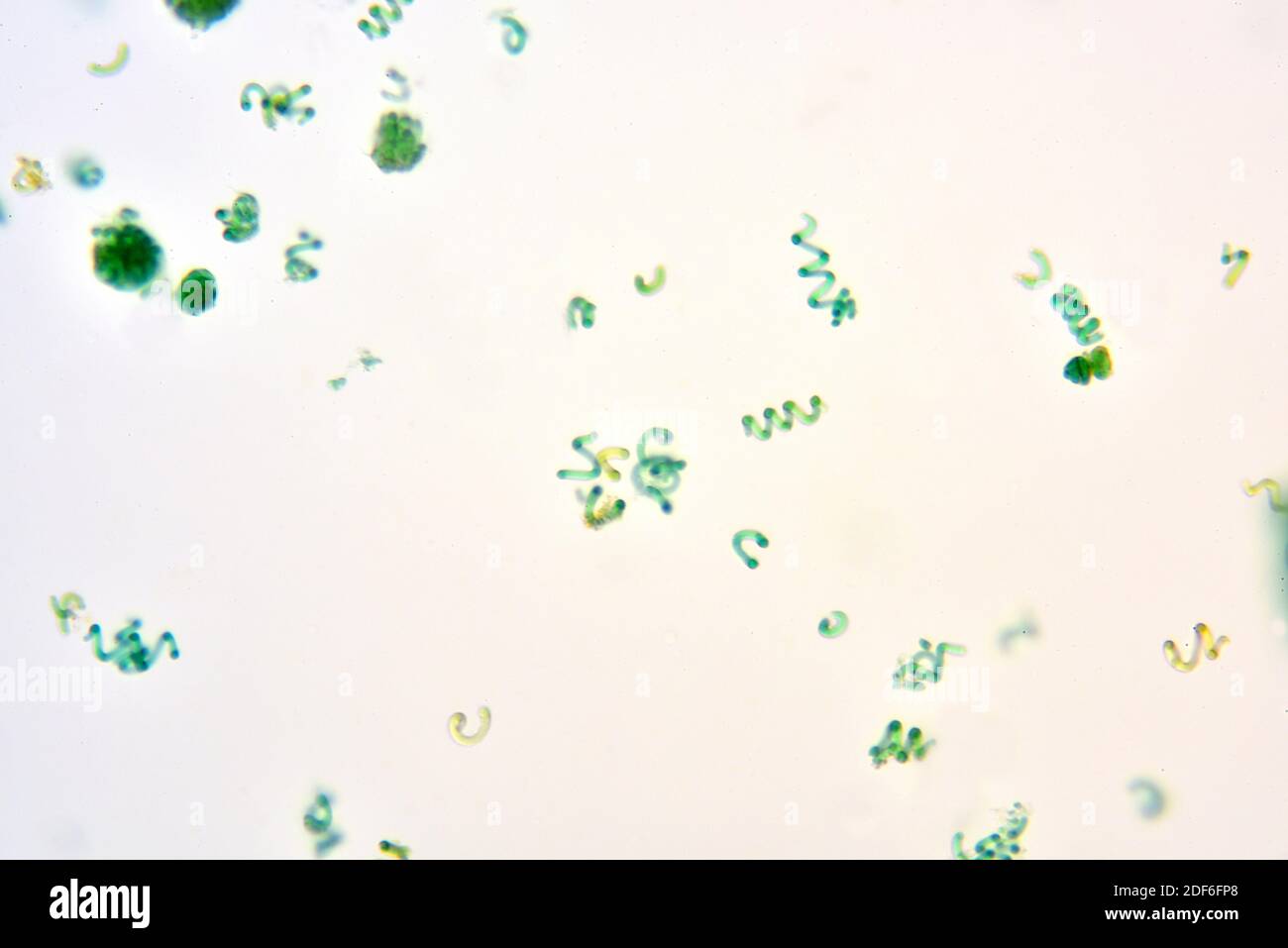 Arthrospira is a cyanobacteria also know as spirulina. Optical microscope X100. Stock Photo