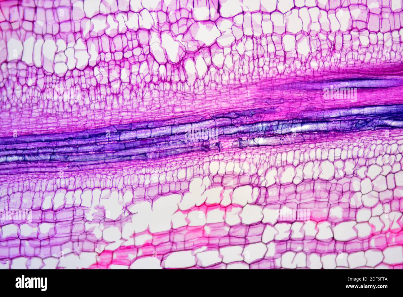 Xylem (Bryonia sp. ). Optical microscope X40. Stock Photo