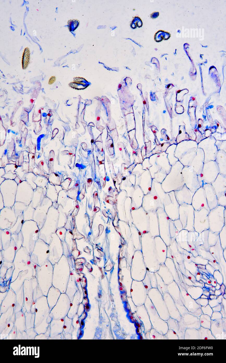 Stigma with pollen (Lilium sp. ). Optical microscope X100. Stock Photo