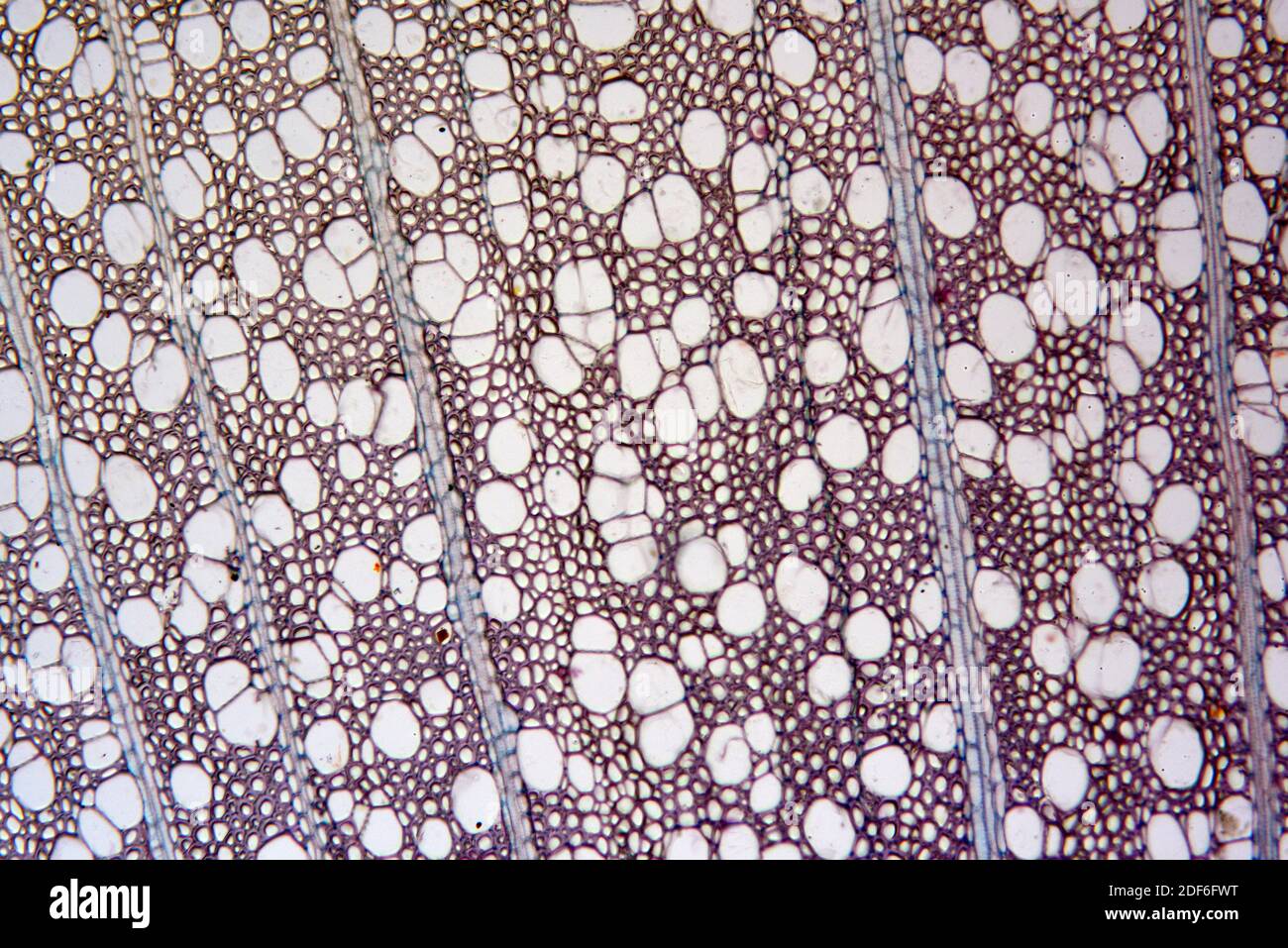 Trunk tree cross section with xylem. Optical microscope X100. Stock Photo