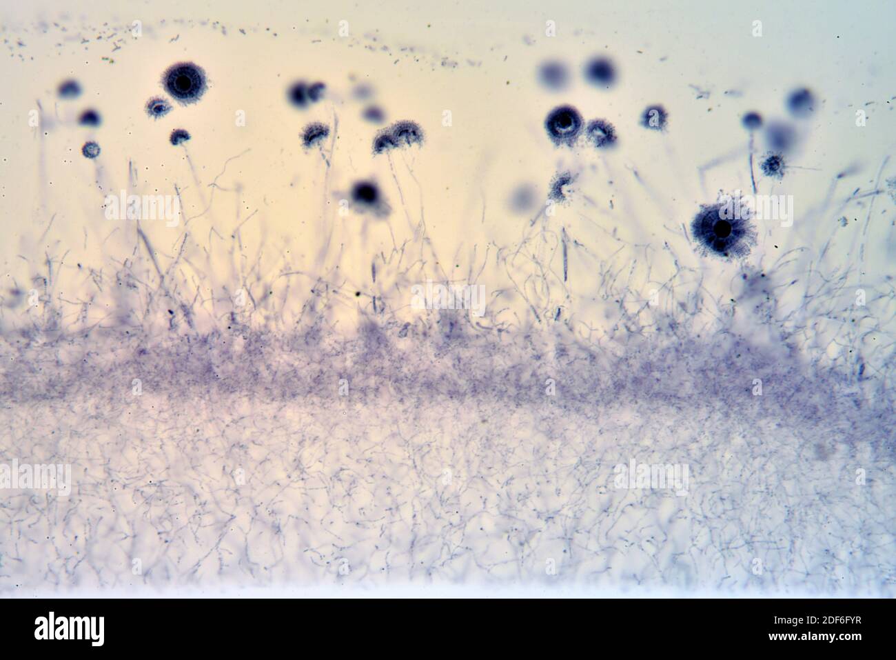 Conidia of Aspergillus, an ascomycota fungi. Optical microscope X100. Stock Photo