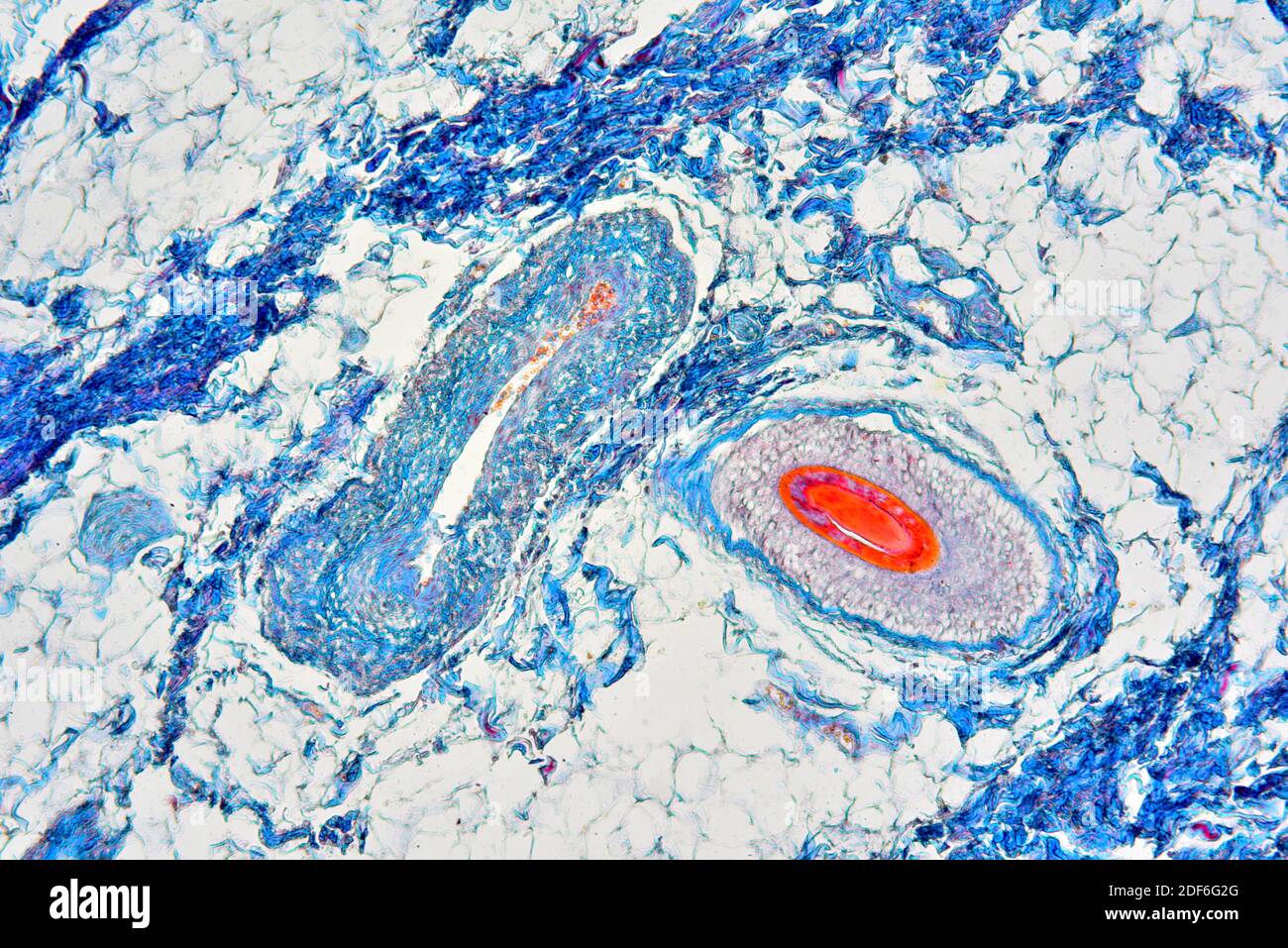 Rectum (large intestine) showing connective tissue, adipose tissue and vessels. Optical microscope X100. Stock Photo