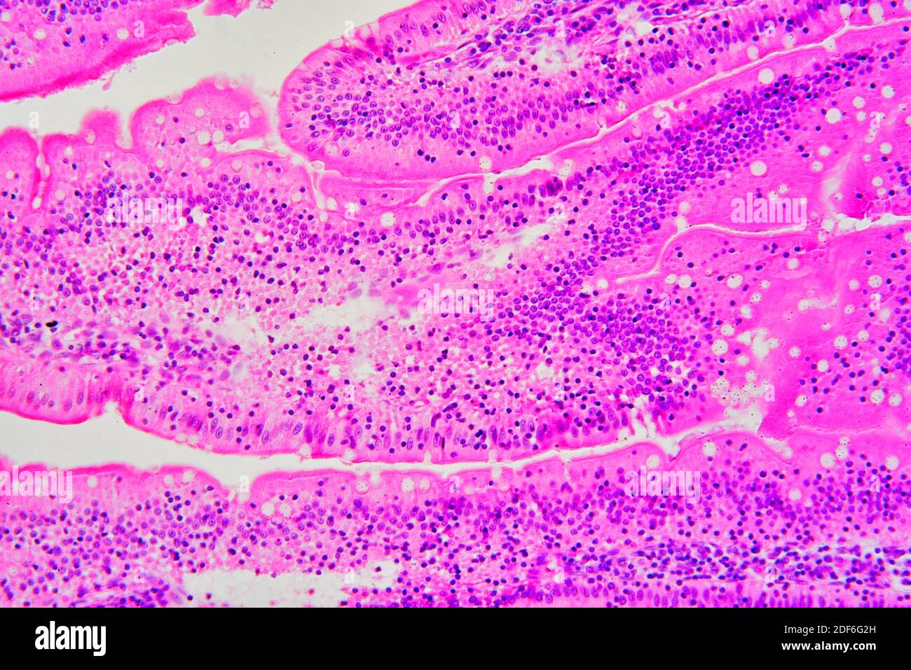 Brunner glands hires stock photography and images Alamy