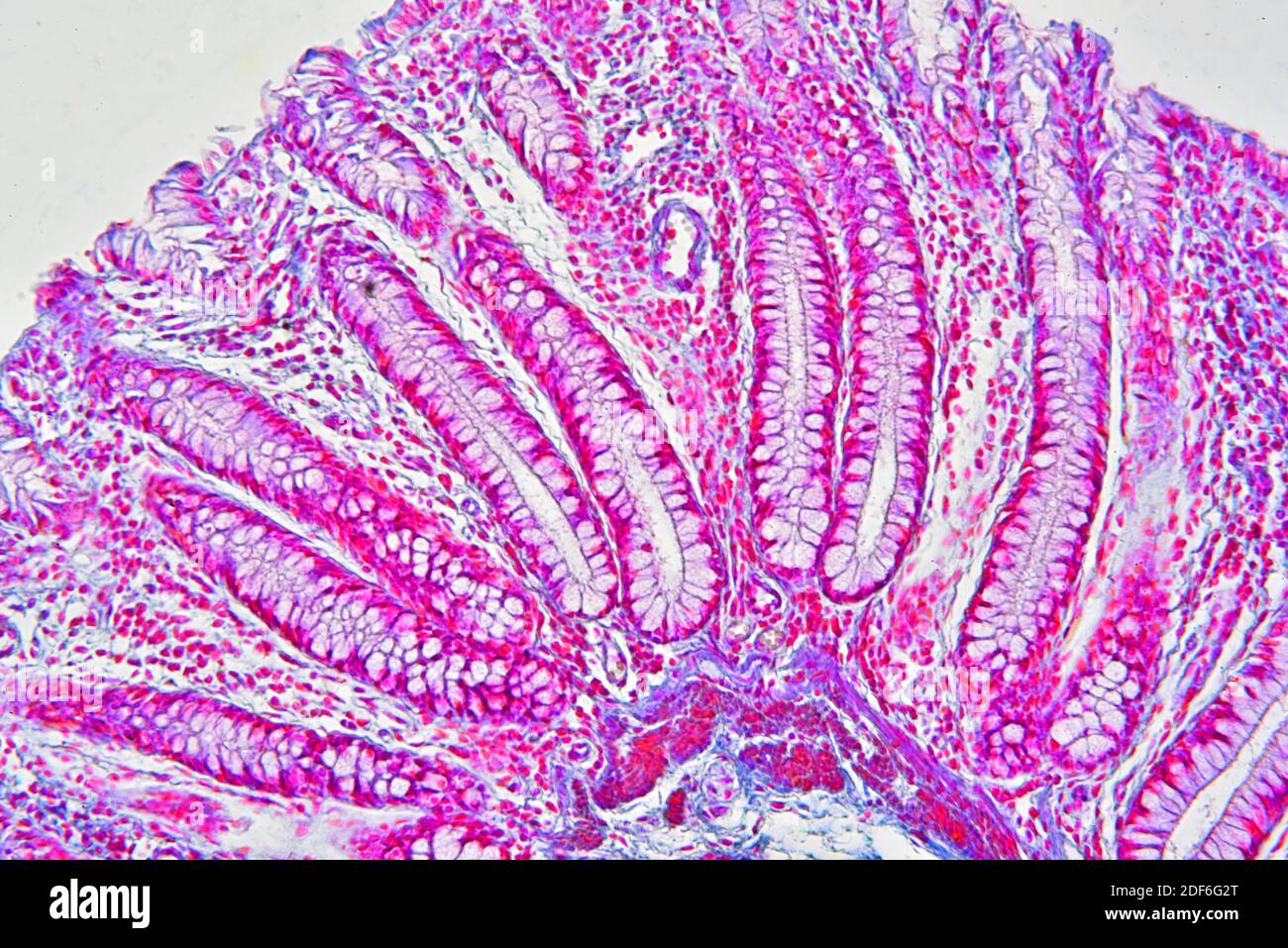 Human colon showing epithelium, mucosa, submucosa, intestinal glands and villi. Optical microscope X100. Stock Photo