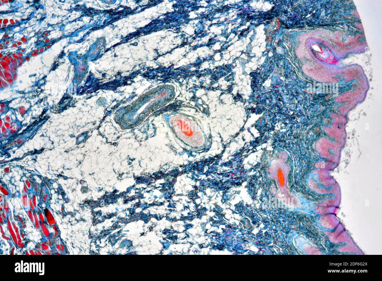 Rectum (large intestine) showing serosa, connective tissue, muscle, adipose tissue and vessels. Optical microscope X40. Stock Photo