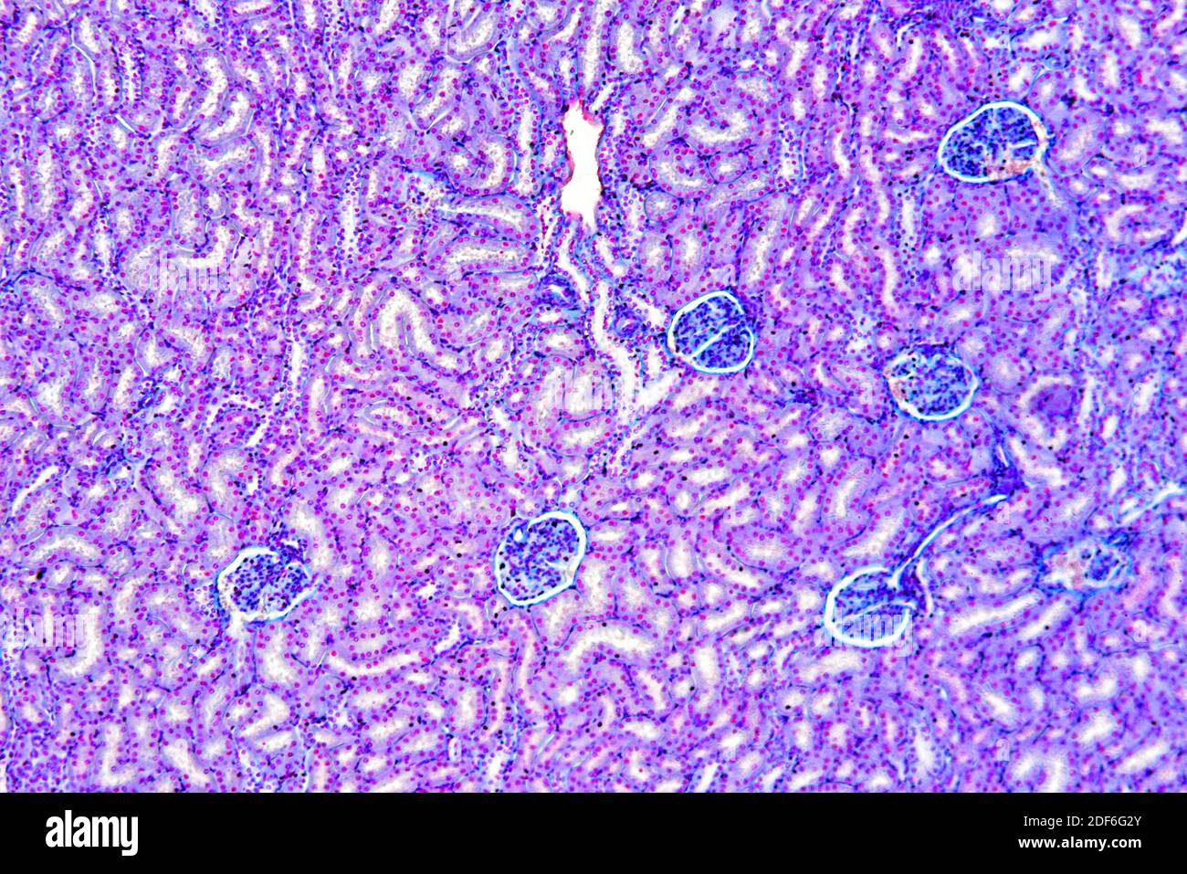 Renal cortex hi-res stock photography and images - Alamy