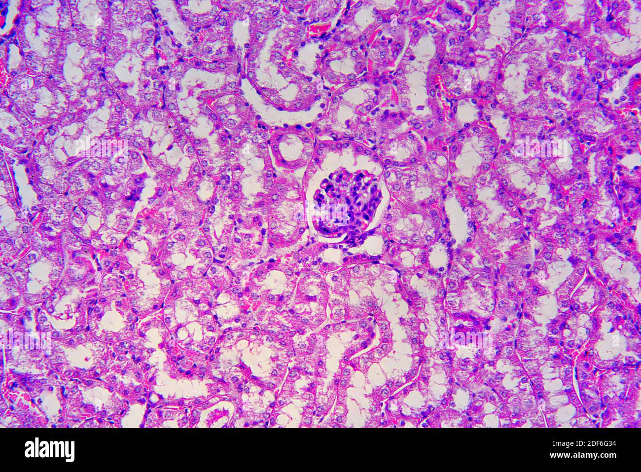 Kidney section showing nephrons, Bowman capsules, glomerulus and distal and proximal tubules. Optical microscope X200. Stock Photo
