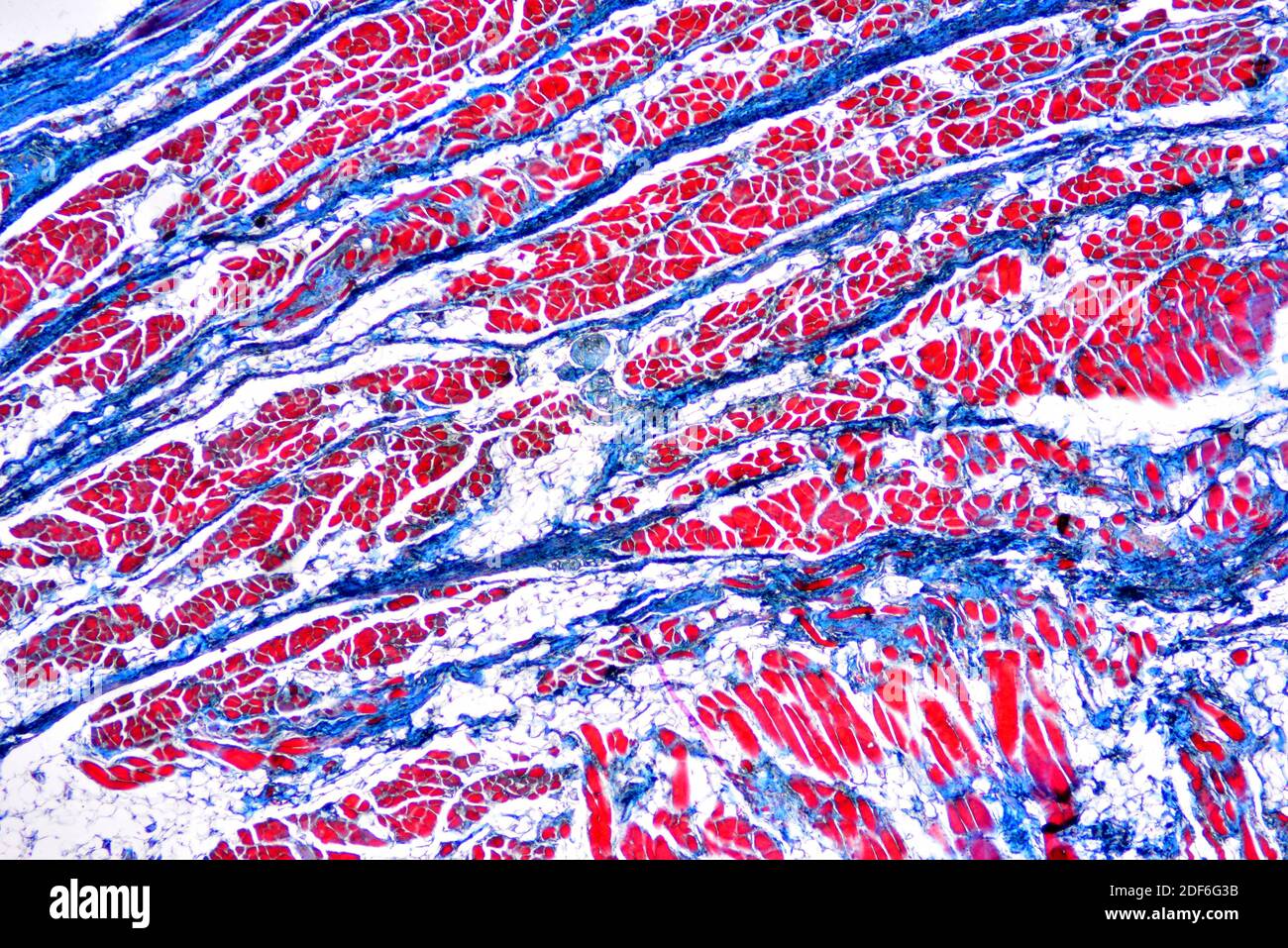 Rectum (large intestine) showing adipose, connective and muscular tissues. Optical microscope X40. Stock Photo