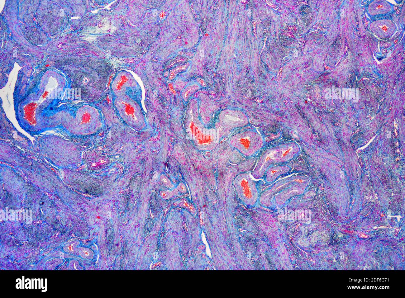 Human uterus or womb. Optical microscope X40. Stock Photo