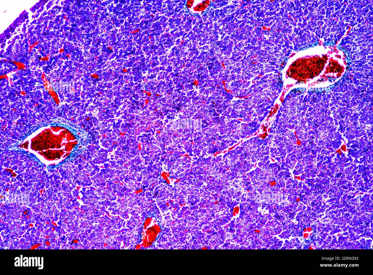 Human fetus liver blood producing. Optical microscope X40. Stock Photo