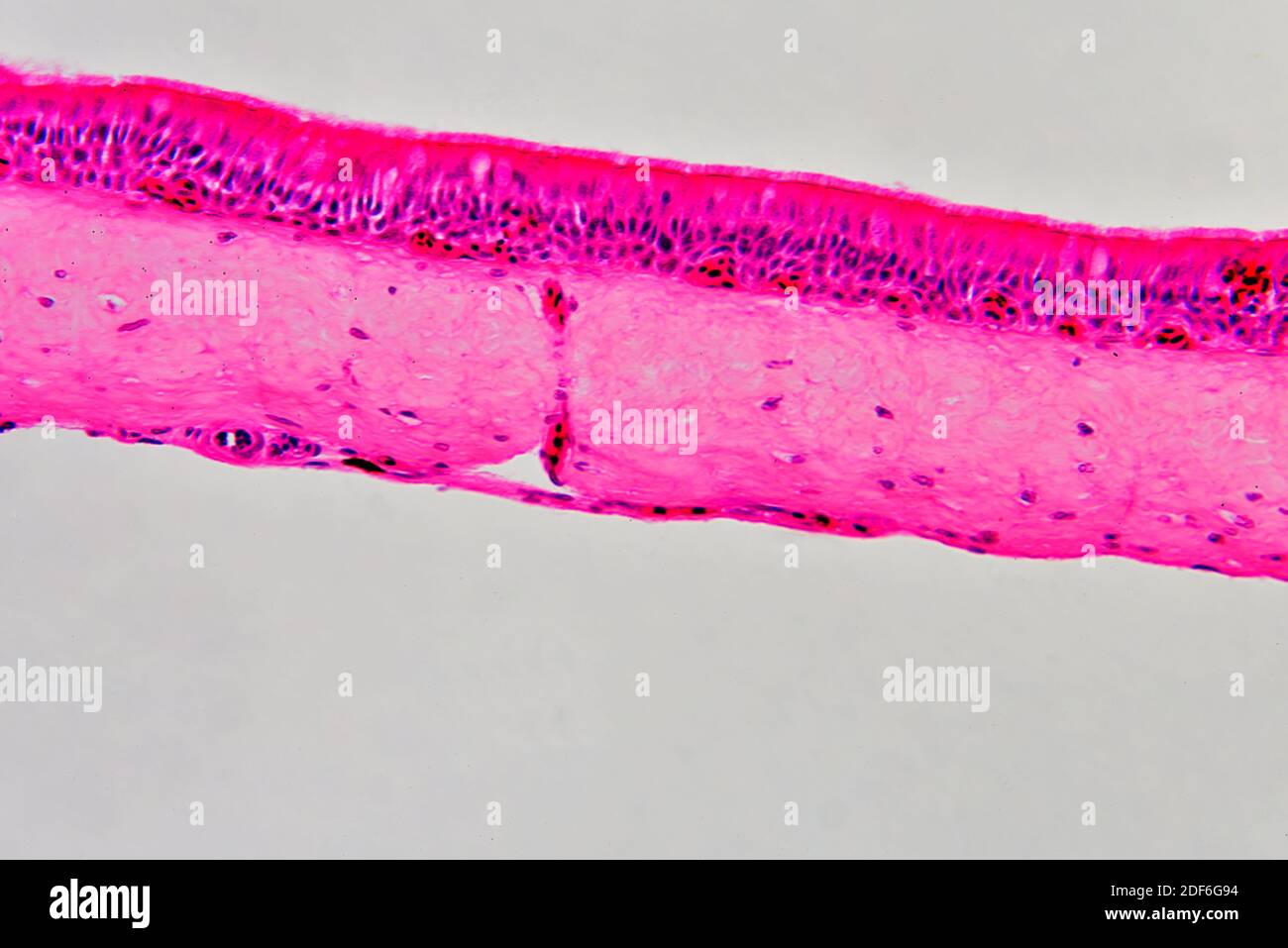 Ciliated epithelium transversal section. Optical microscope X200. Stock Photo
