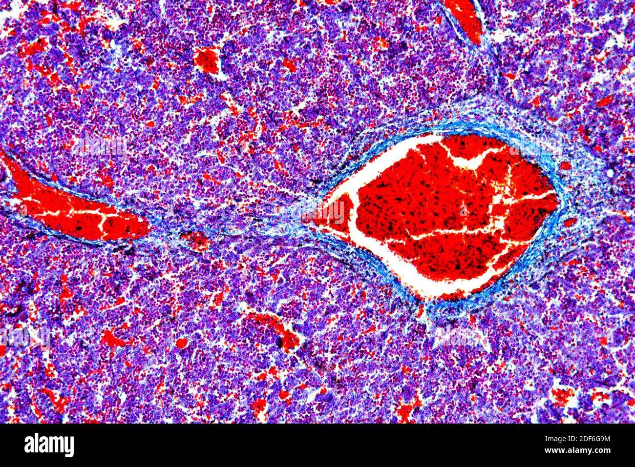Human fetus liver blood producing. Optical microscope X100. Stock Photo