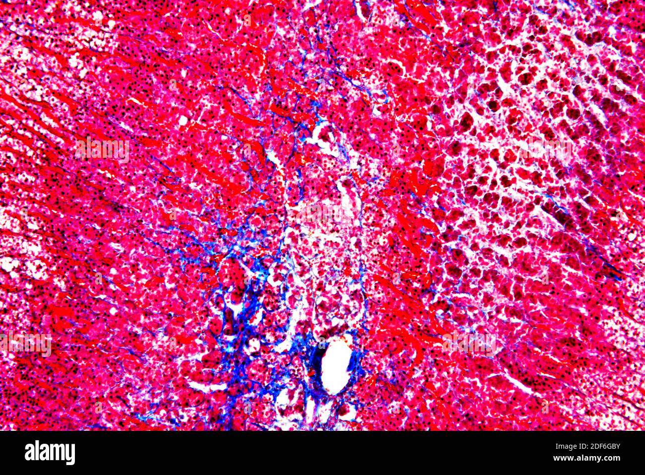 Human adrenal or suprarenal gland showing medulla. Produces adrenaline, aldosterone, and cortisol. Optical microscope X100. Stock Photo