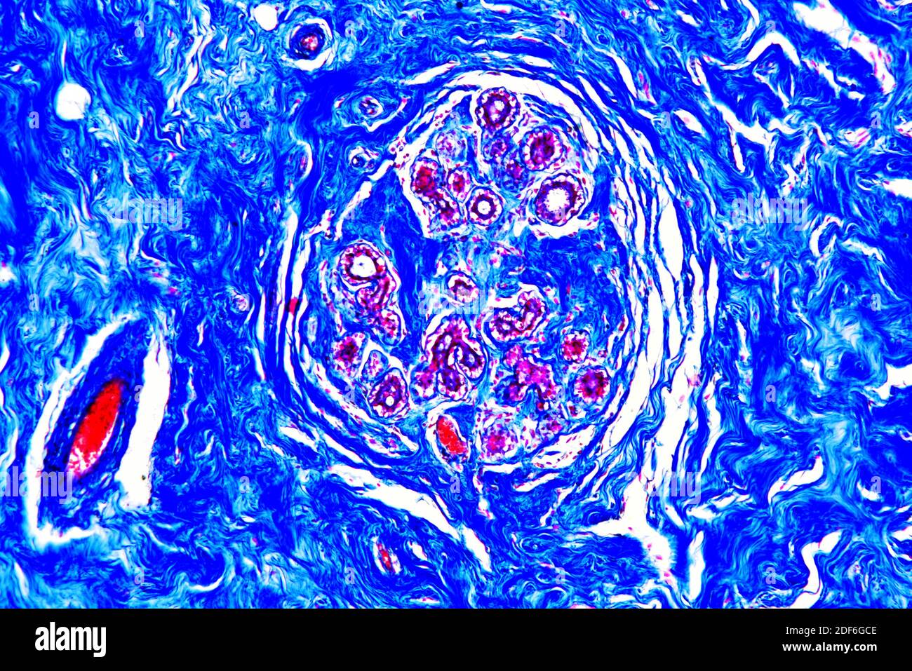 Blood Vessel Histology High Resolution Stock Photography and Images - Alamy