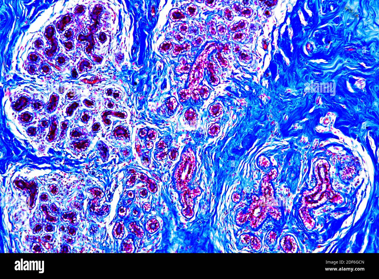 Human mammary gland. Optical microscope X100. Stock Photo