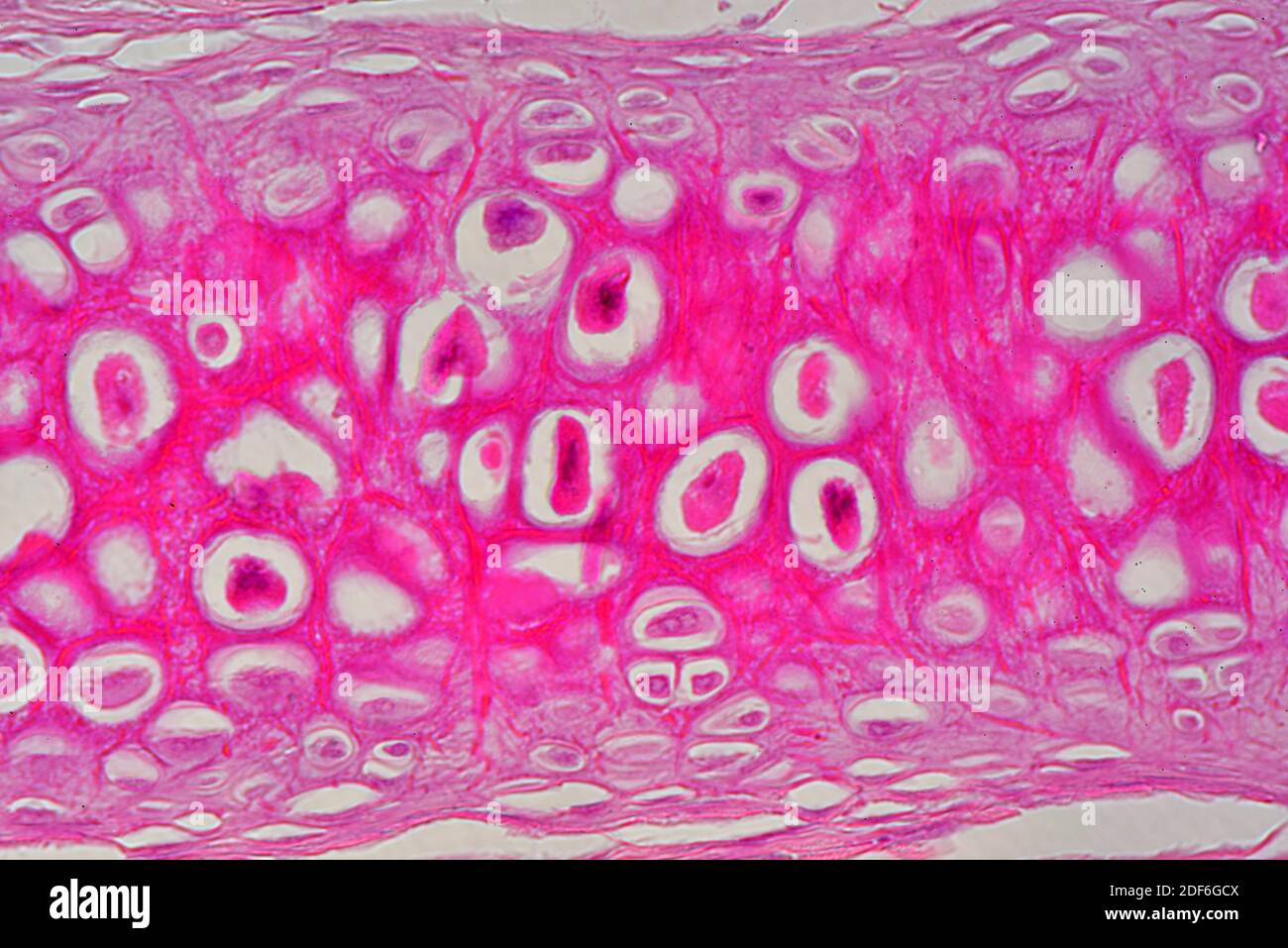 Elastic cartilaginous tissue from the ear showing chondrocytes, elastin fibers and matrix. Optical microscope X400. Stock Photo