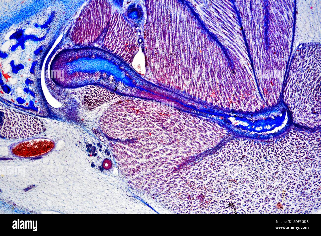 Inner ear with cochlea and tympani. Optical microscope X40. Stock Photo