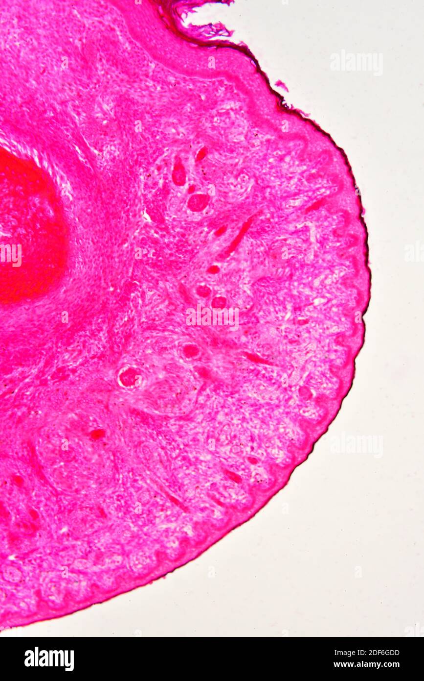 Epithelium of human fetus finger. Optical microscope X100. Stock Photo