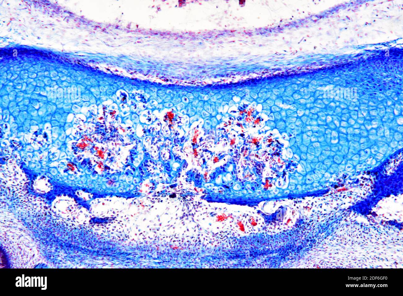 Elastic cartilaginous tissue from the ear showing chondrocytes, elastin fibers and matrix. Optical microscope X100. Stock Photo