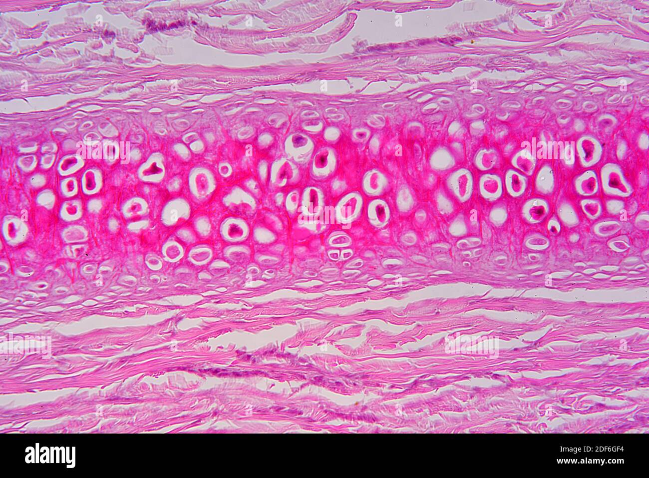 Elastic cartilaginous tissue from the ear showing chondrocytes, elastin fibers and matrix. Optical microscope X200. Stock Photo