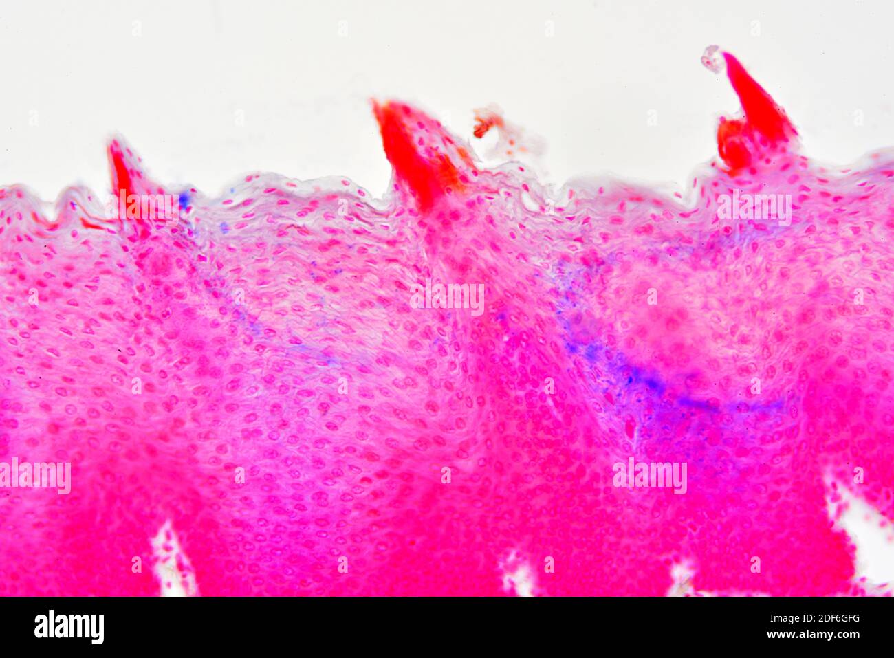 Tongue section showing lingual papillae. Optical microscope X200. Stock Photo
