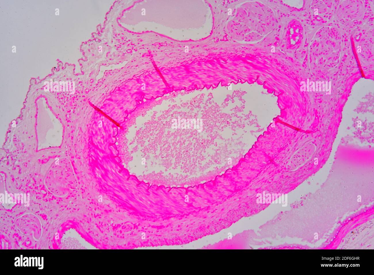 Venule (blood vessel). Optical microscope X100. Stock Photo