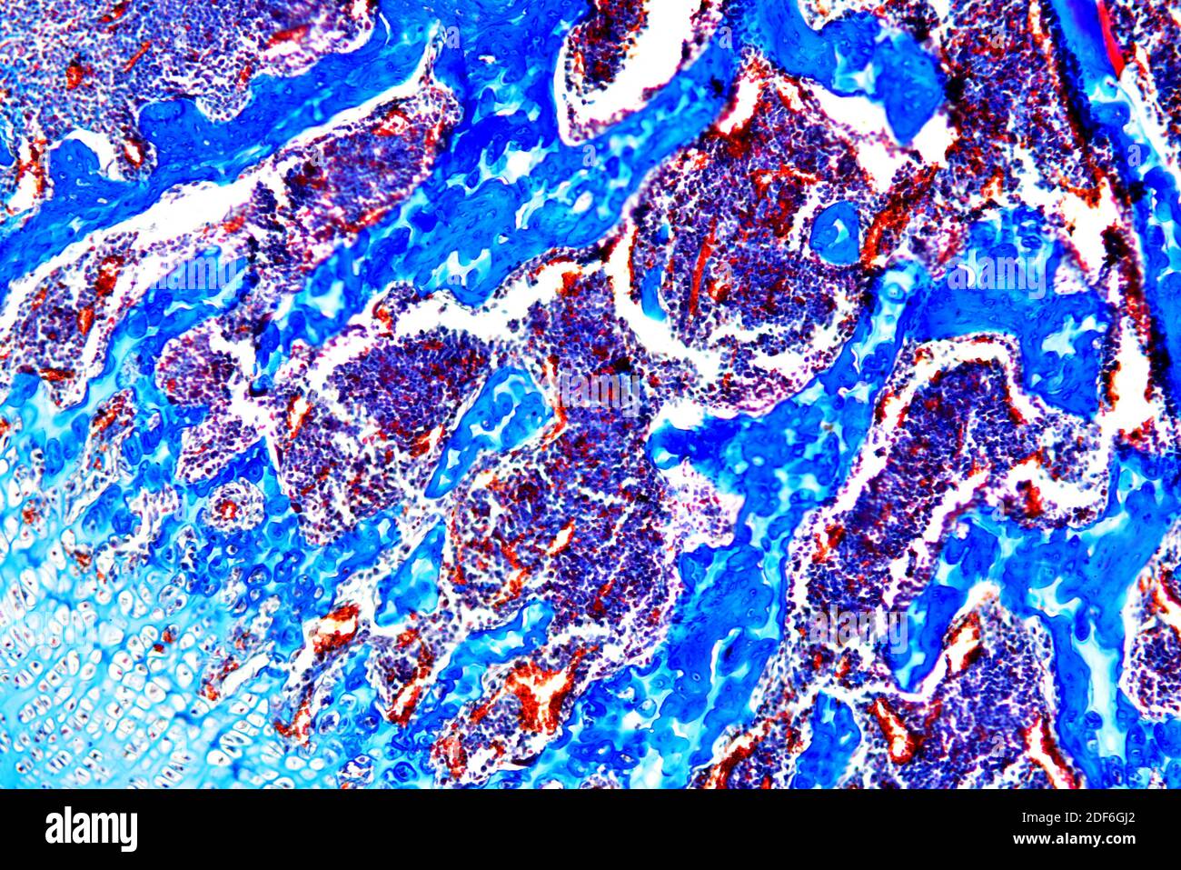 Cancellous or spongy bone is an hematopoietic organ. Optical microscope X100. Stock Photo