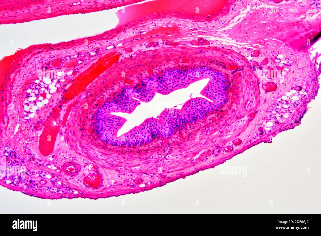 Artery (blood vessel) showing tunica adventitia, media and intima. Optical microscope X100. Stock Photo