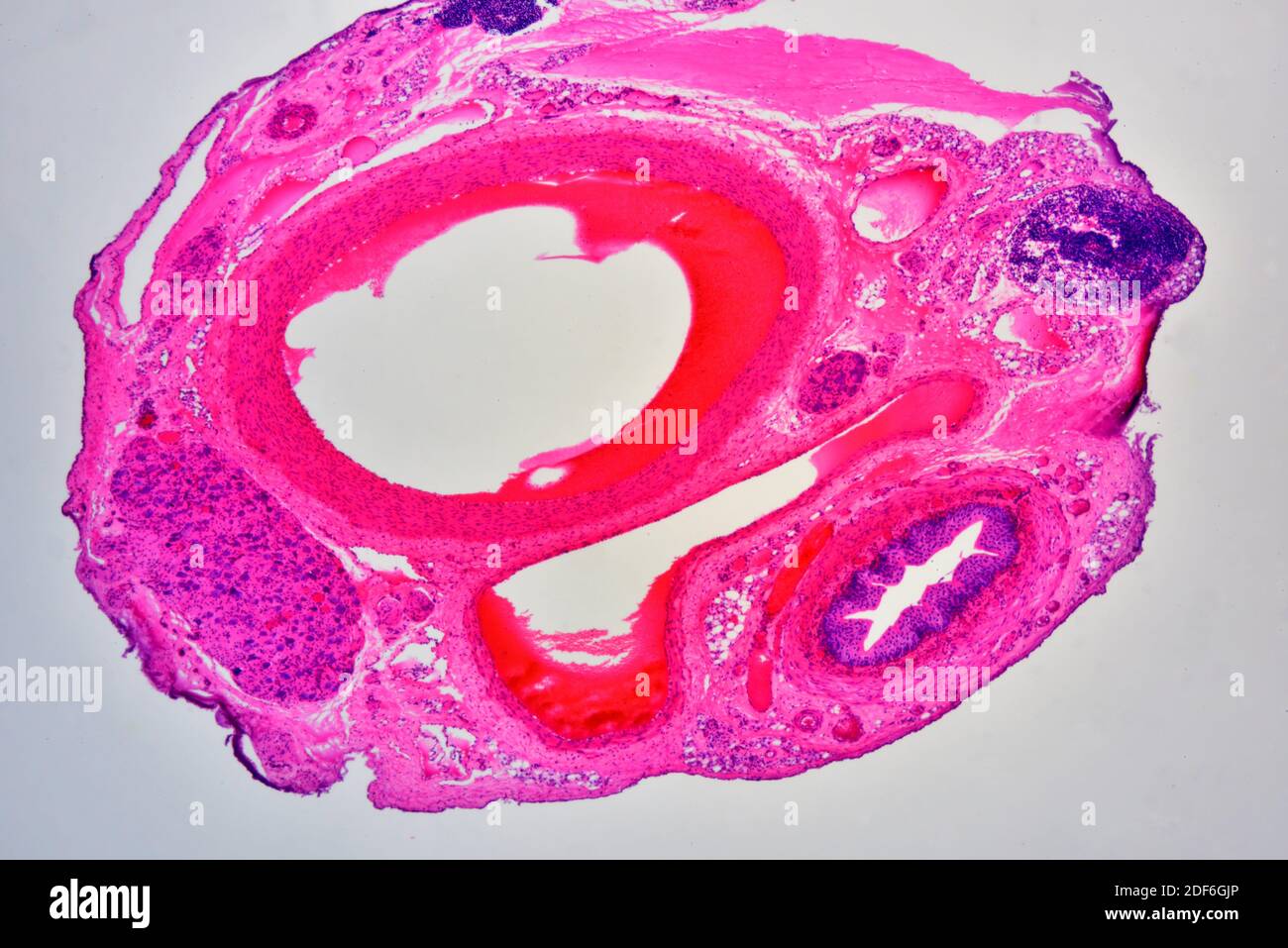 Artery (right) and vein (blood vessels). Optical microscope X40. Stock Photo