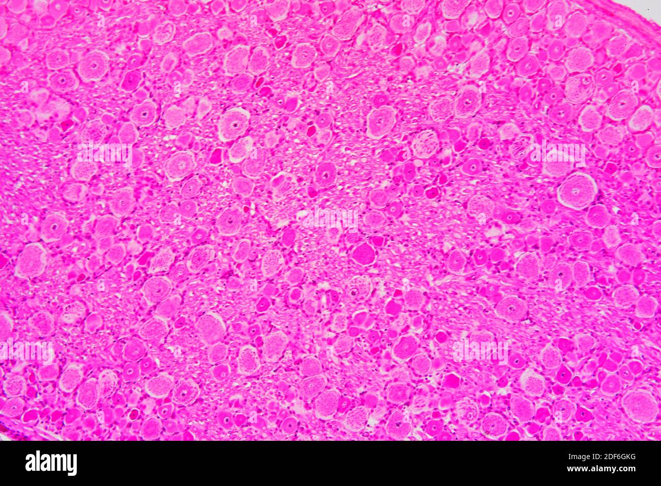 Spinal ganglion cross section. Optical microscope X100. Stock Photo