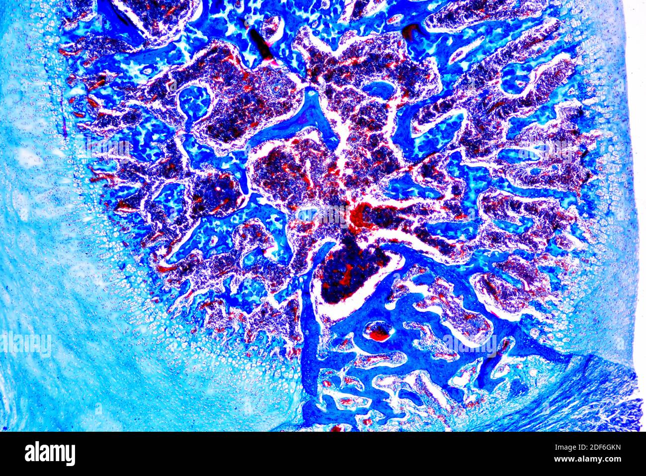 Cancellous or spongy bone is an hematopoietic organ. Optical microscope X40. Stock Photo
