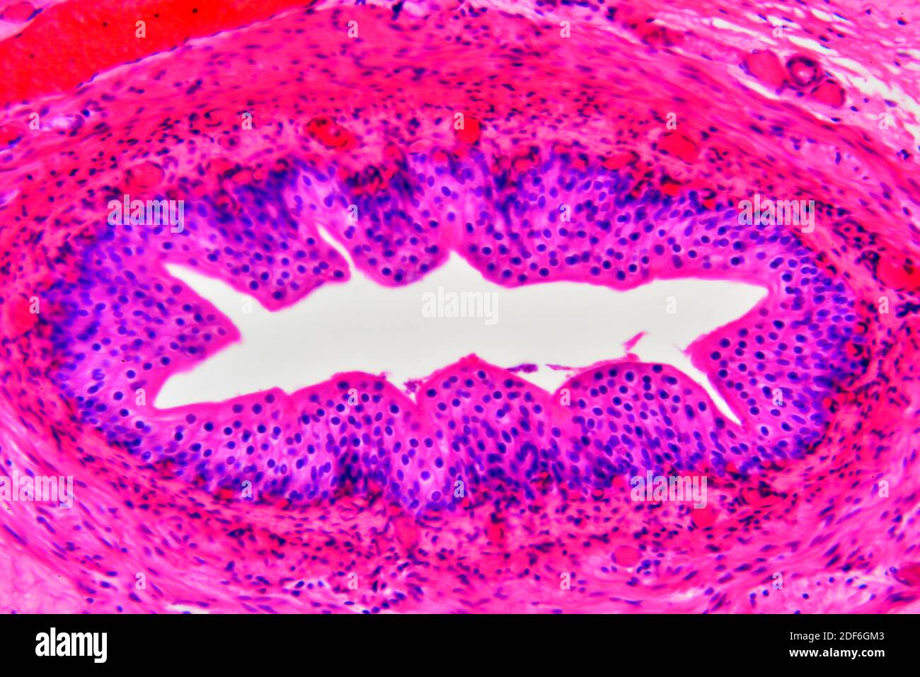 Tunica hires stock photography and images Alamy