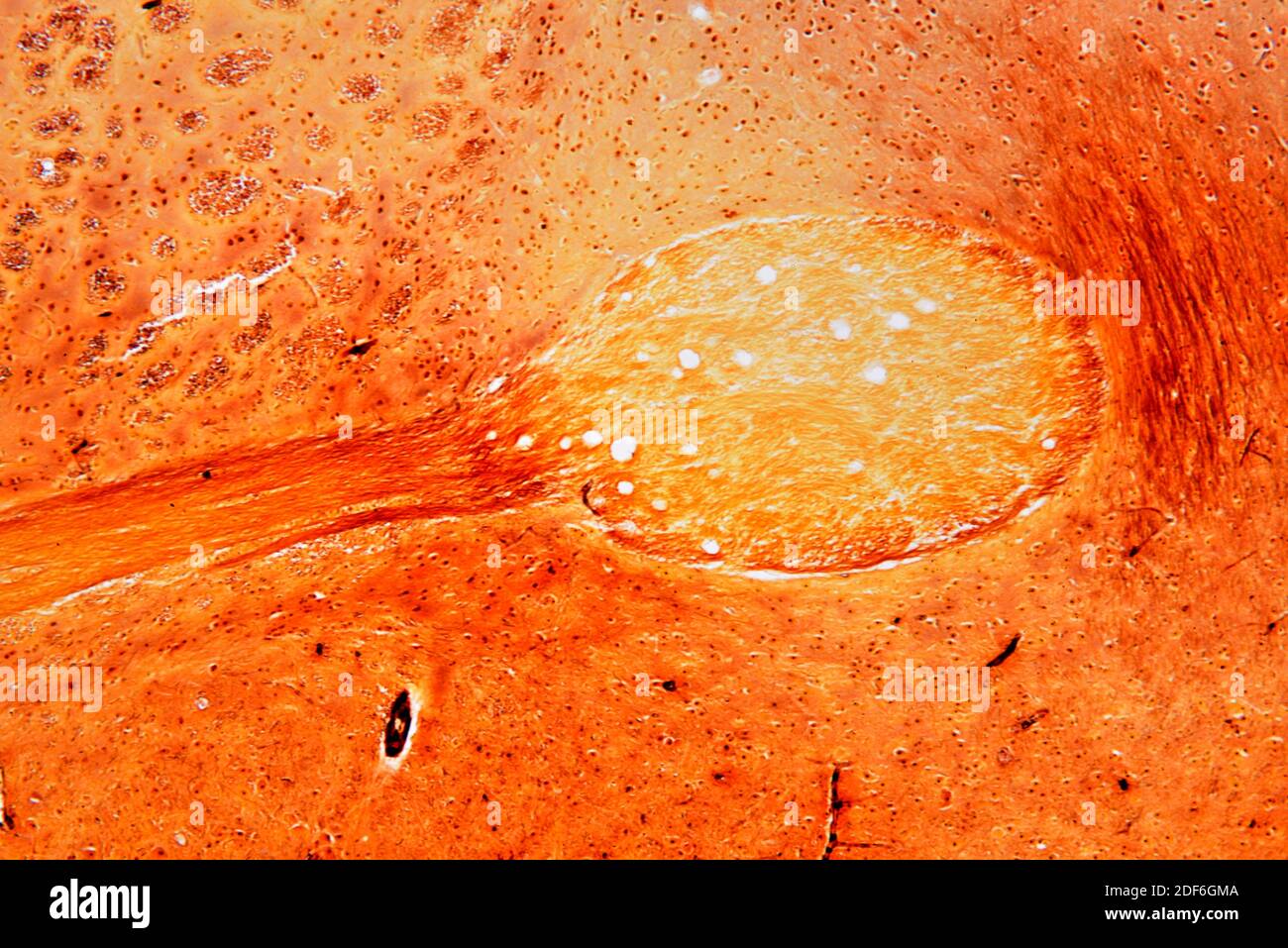 Brain, Cajal stain. Optical microscope X100. Stock Photo
