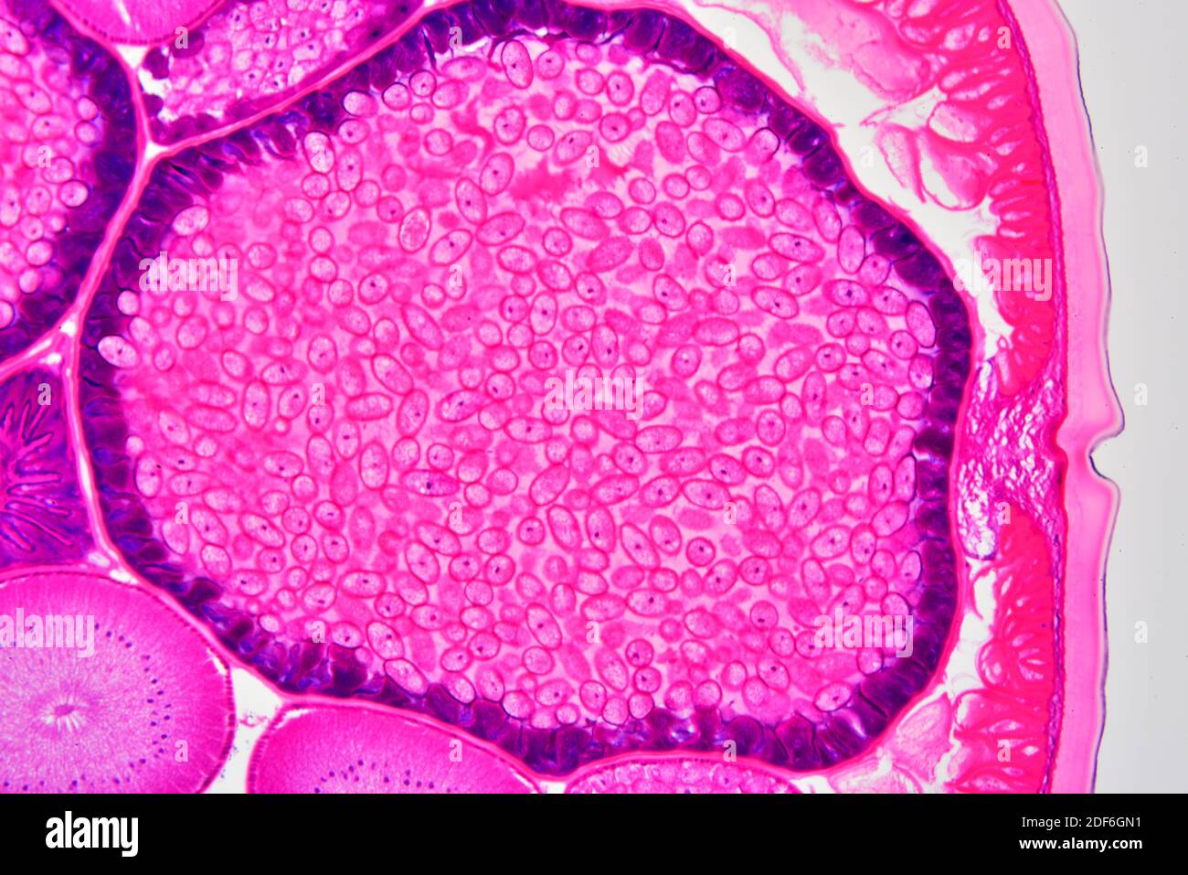 Ascaris lumbricoides female showing cuticle, epithelium, longitudinal muscles and uterus with eggs. Optical microscope X100. Stock Photo