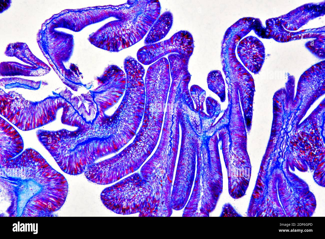 Sea anemone Actinia, longitudinal section showing septa. Optical microscope X100. Stock Photo