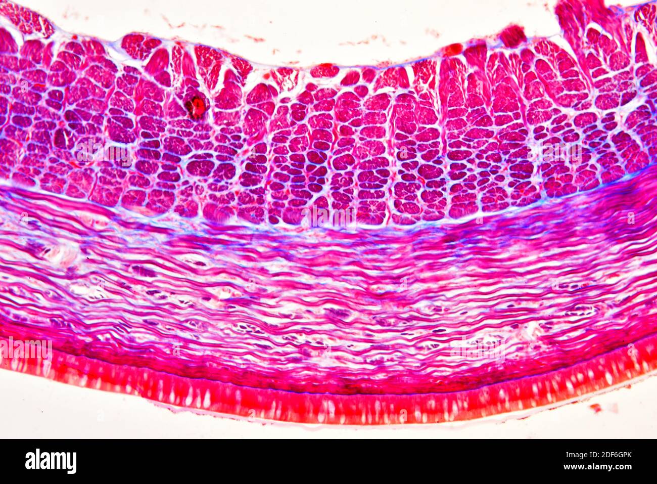 Earthworm (Oligochaeta) cross section showing cuticle, epidermis and circular and longitudinal muscles. Optical microscope X100. Stock Photo