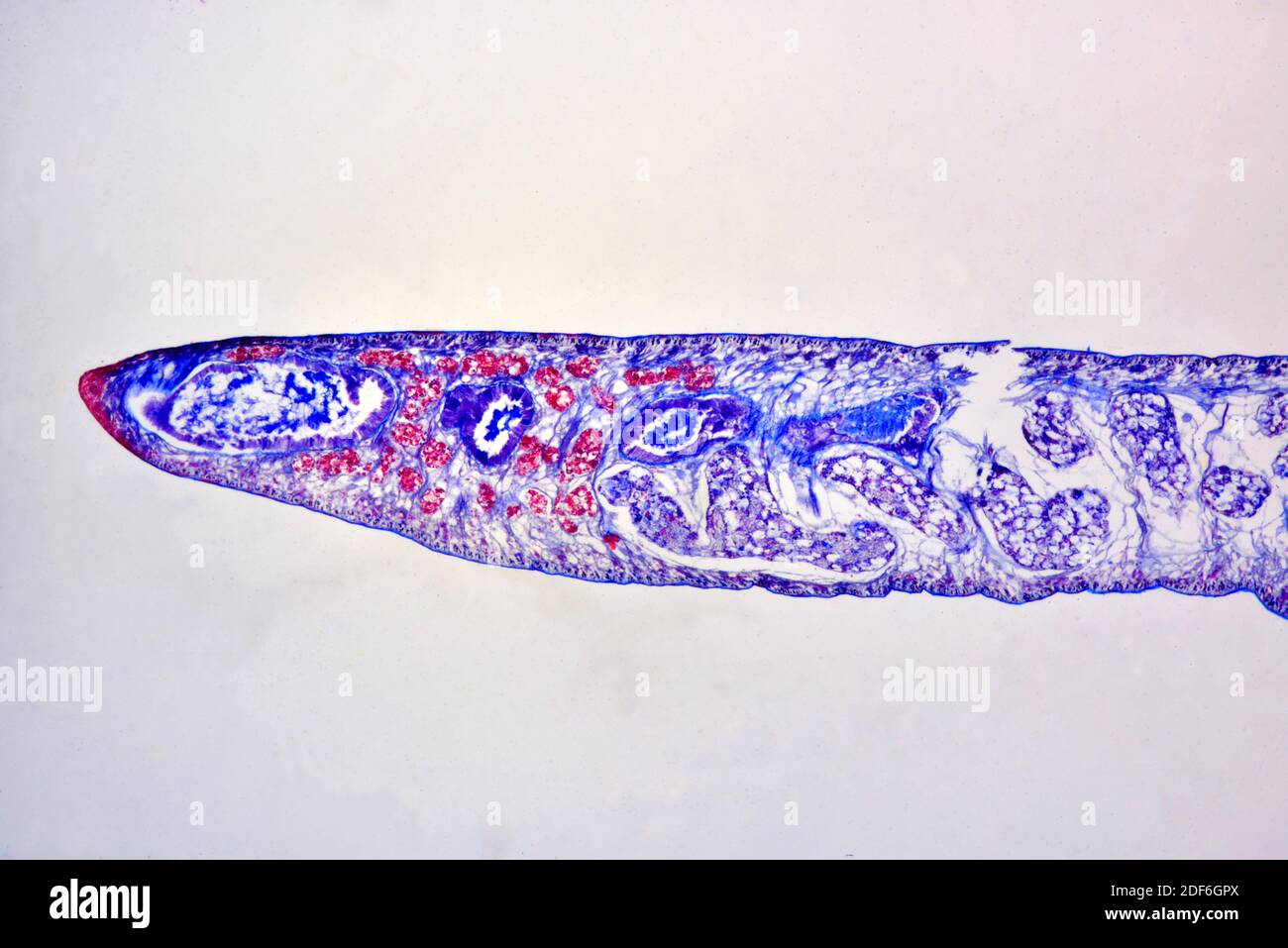 Lancet liver fluke (Dicrocoelium dendriticum or D. lanceolatum), longitudinal section. Optical microscope X40. Stock Photo