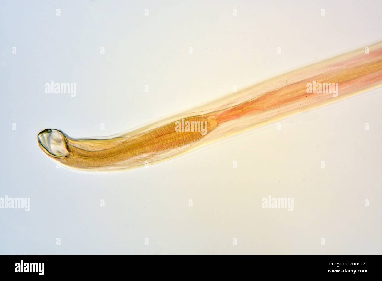 tapeworm under a microscope