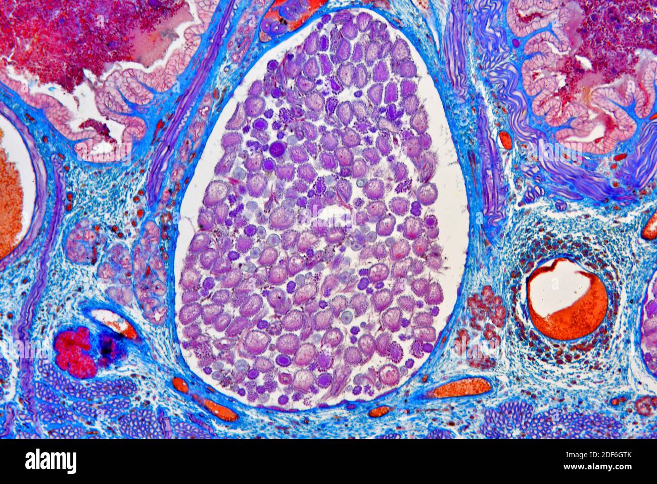 European medicinal leech (Hirudo medicinalis) cross section showing uterus and intestine and crop diverticulum. Optical microscope X100. Stock Photo