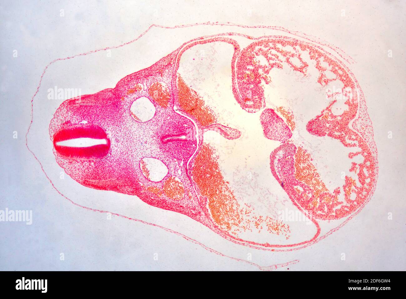 Pig embryo cross section showing spine, foregut, pleural cavity, heart and head. Optical microscope X40. Stock Photo