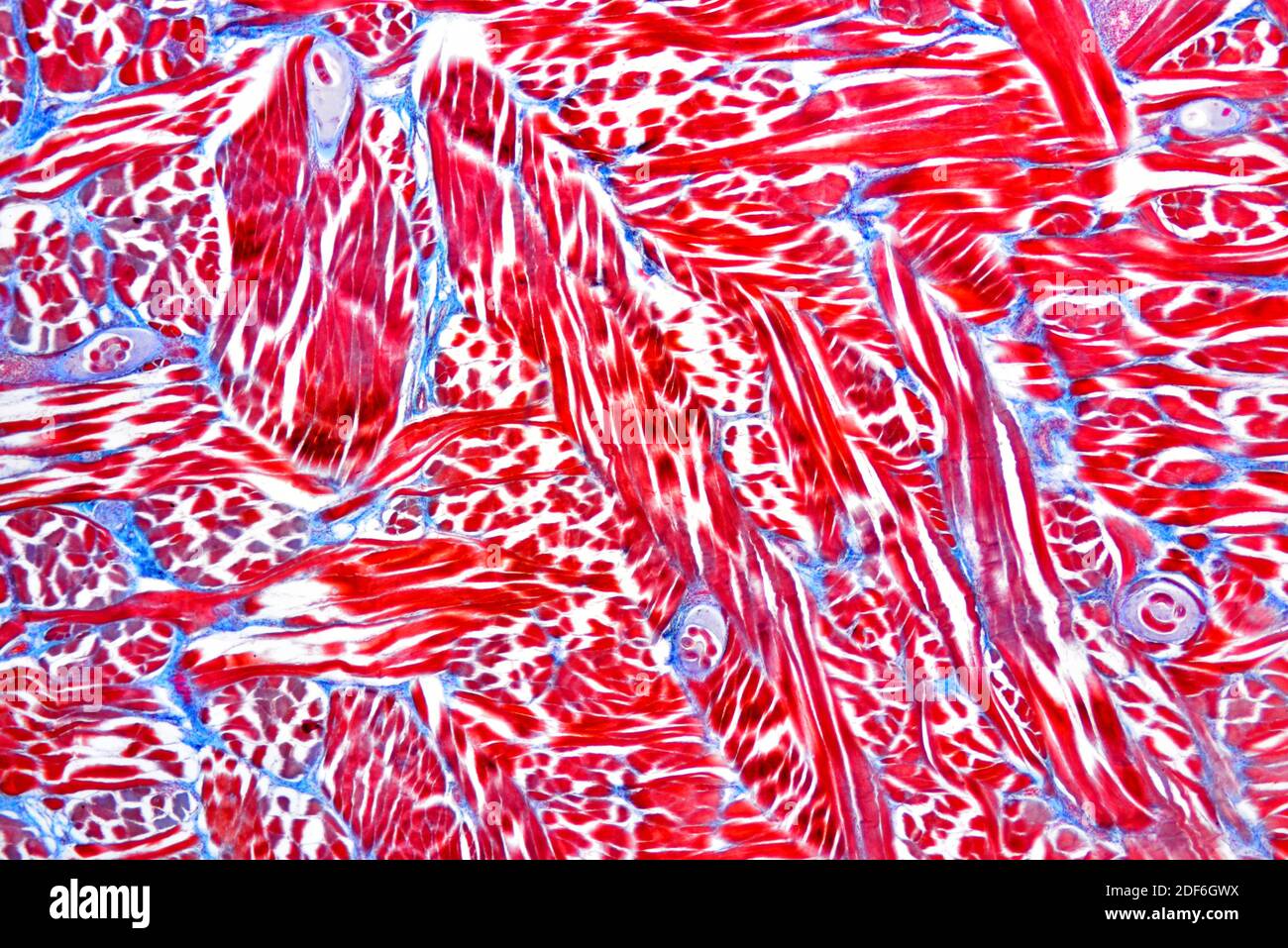 Pork worm larvae (Trichinella spiralis) in a muscular tissue. Optical  microscope X40 Stock Photo - Alamy