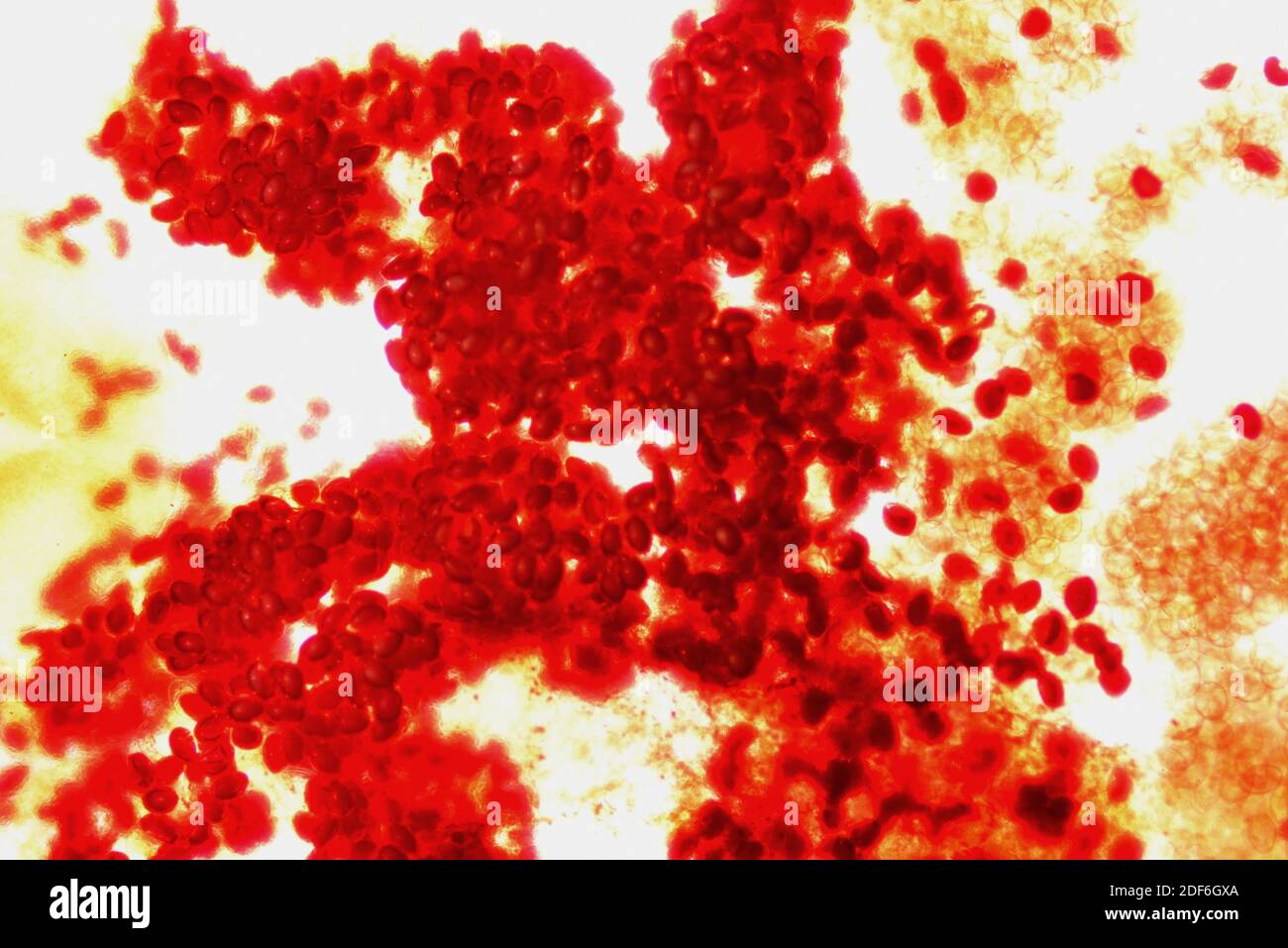 Common liver fluke (Fasciola hepatica or Distomum hepaticum) eggs. Optical microscope X40. Stock Photo